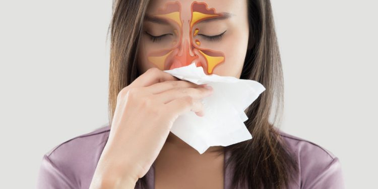 13 Safest Natural Remedies For Allergy Relief