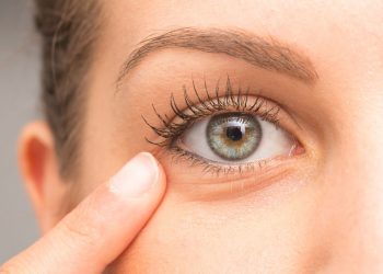 5 Best Ways To Get Rid Of Under Eye Wrinkles